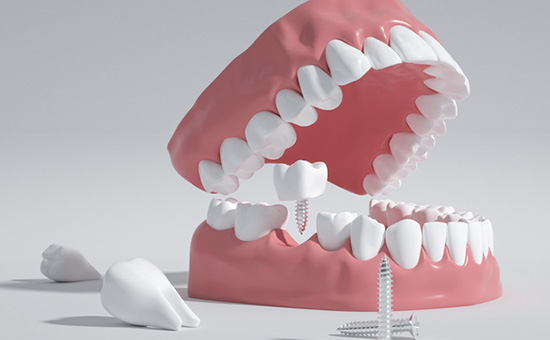 南京市固定修复牙齿医院上榜清单强榜前10强权威机构评测（医泰口腔一起来看看哪些牛