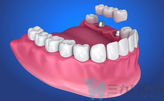 12月直击!南京牙齿矫正医院是哪个医院实力排名[前五]南京纠正牙齿的较佳年龄