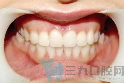 徐州实力好的全瓷牙医院排名前六,看徐州哪家全瓷牙好实力靠谱