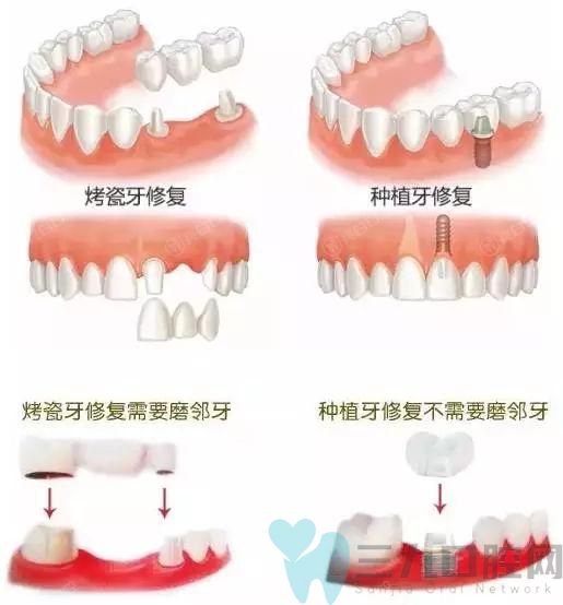 杭州靠谱服务好的牙科医院排名，是烤瓷牙正规服务好的牙科诊所