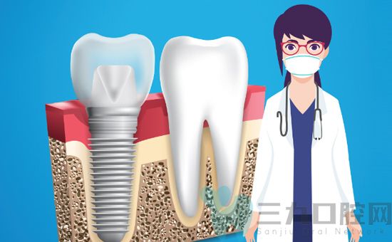 （网上预约指南）南京什么医院能治疗种植牙_第二磨牙种植牙多少钱